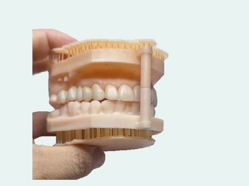 Prótesis fija de zirconio y disilicato sobre modelo con pines
